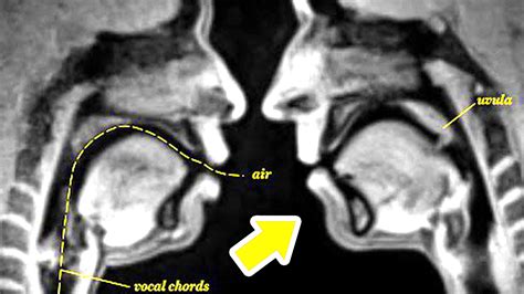 what does a creampie look like|An inside view of sex: MRI scanner captures intercourse as you。